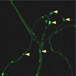 Proteinbildung an den Synapsen (Pfeile) während der Entstehung von Langzeiterinnerungen | Copyright: mcgill.ca/Science