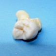 Zahnschmelz nimmt eine Spitzenstellung in der Härteskala biologischer Materialien ein. In langjährigen Forschungsarbeiten gelang es, dessen komplexe Struktur zu entschlüsseln, jedoch hat man den Grund für die einzigartige Härte, Festigkeit […]
