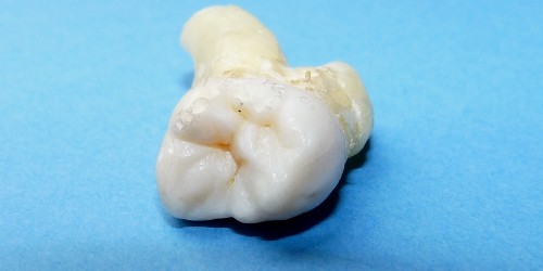 Zahnschmelz nimmt eine Spitzenstellung in der Härteskala biologischer Materialien ein. In langjährigen Forschungsarbeiten gelang es, dessen komplexe Struktur zu entschlüsseln, jedoch hat man den Grund für die einzigartige Härte, Festigkeit […]